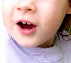 Echolalia is repetitive speech, a common feature of communication behavior in children with Autism, Asperger's syndrome and other developmental disorders. Early intervention would seek to address this if it became inappropriate, but many see it as a stepping stone in communication development.