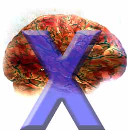 Fragile X syndrome,  or  Martin-Bell syndrome, is a syndrome of X-linked mental retardation that can occur with Autism, Asperger's and other autism spectrum disorders.